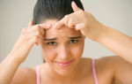 Уход за проблемной кожей лица: очищение, тонизирование, защита и питание
