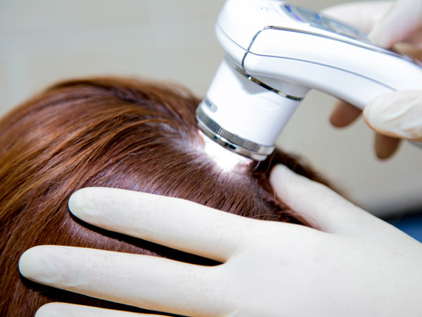 Норма выпадения волос в день у женщин: внешние и внутренние факторы