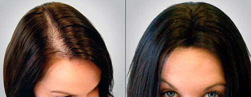 Чеснок для волос: лечим корни и восстанавливаем повреждённые пряди