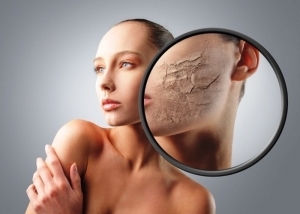 Шелушится кожа на лице – что можно сделать, чтобы вернуть гладкость?